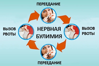 Лечение булимии в Перевозе
